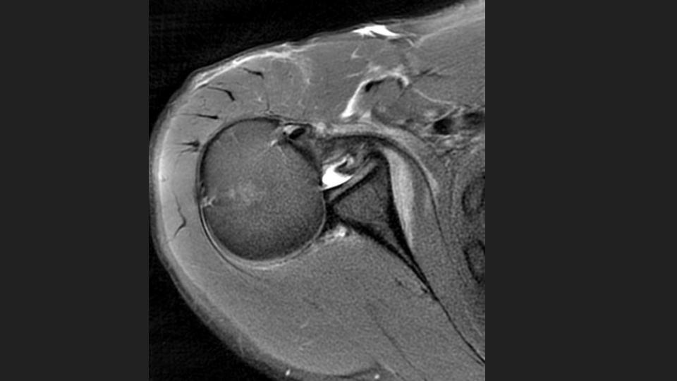 Figure 6 for case dislocation ( RID4770 )